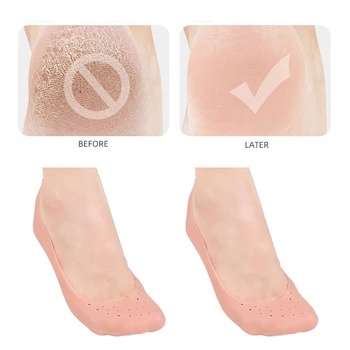 1 Pora gelio kojinės silikoninė kojų apsauga nuo skausmo malšinimo įtrūkimų prevencija Drėkina negyvą odą šalinančią kojinę su skylių pėdų priežiūros priemone